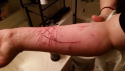 &gt;Being a cat owner.Ugh, woke up this morning to one of my cats (the asshole one) shredding my left arm to pieces.More to the story and bloody picture after the break, so trigger warning or something.My other cat was sleeping on my pillow next to my