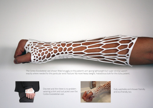 engineeringisawesome: Some more information on the 3D-Printed cast. futuretechreport: Cortex: The 3D