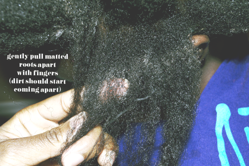 subtle-queen:naijacurls:Detangling Natural Hair After Removing BraidsThis weekend, my little sis rem