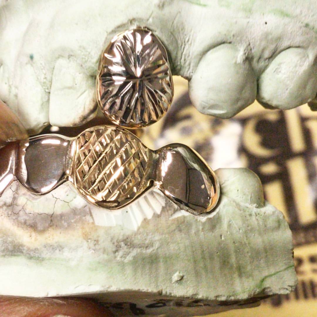 chigrillz-goldteeth:  😬 Custom #twotone yellow diamond cut on white bottom w/