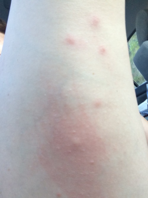 youcantseebutimmakingaface: vampireapologist: My legs are destroyed where is the queen mosquito so I