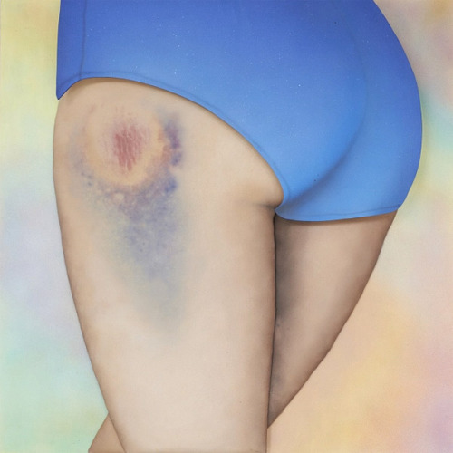 thingstolovefor:    Riikka Hyvönen taps into an unexpected kind of beauty in the athletes who send her shots of the bruises (or “kisses” in roller derby terms) they wear like badges of honour, turning these photographs into large-scale sculptural