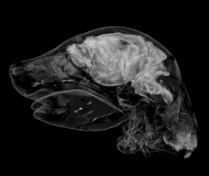 Reversing Brain Damage