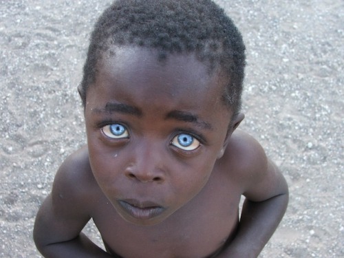bulinruse:  sixpenceee:  The Boy with the Sapphire Eyes photographed by Vanessa Bristow. These photos were first met with suspicion but Vanessa assures that it wasn’t photoshopped. An ophthalmologist states that these characteristics probably represents