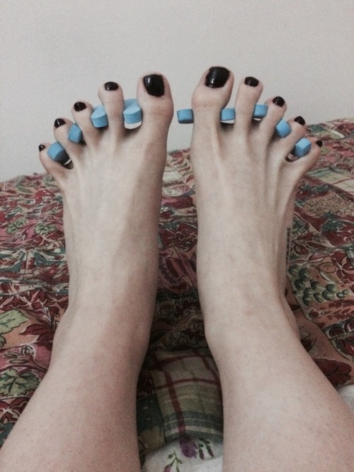 baleseistorta: Take care of your toes