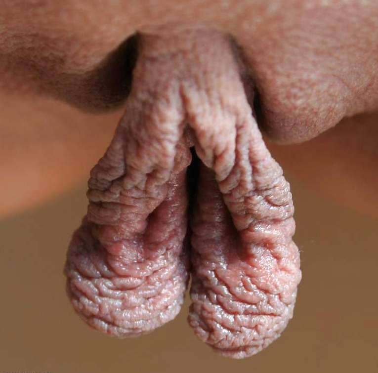 Meaty Pussies