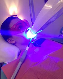 Teeth whitening by alettaoceanxxxx_