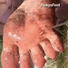 Toe-T-Ally