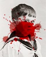 historyofromanovs:  “Hemophilia is as old as man. It has come down through the