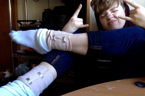 I’m so happy my friend has like legitimate wound-cleaner and gauze and ace bandages so last night I 
