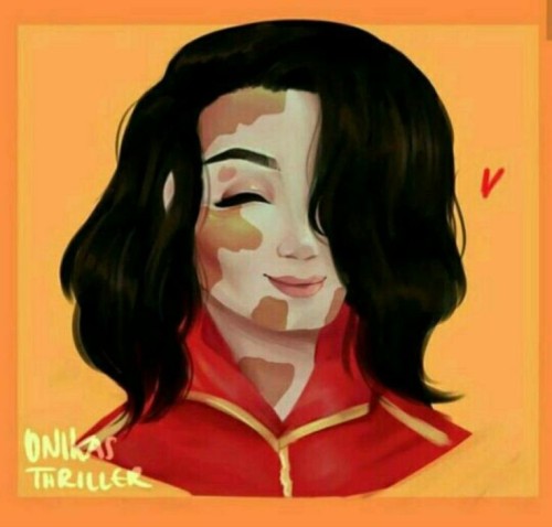 I Think We Should Have More Fanart With Michael's Vitiligo Because His Vitiligo Is Always Drawn Beautifully