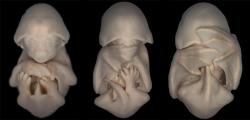 the-science-llama:  Bat Embryos The first image are embryos of the species Molossus rufus, the black mastiff bat. These images formed part of an embryonic staging system for this species. — By Dorit Hockman The second image shows a bat embryo developing