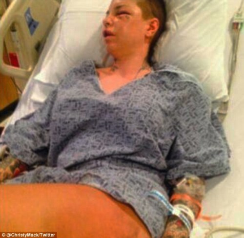 365daysofhorror:  PLEASE reblog this and get the word out. War Machine, an MMA fighter, allegedly brutally beat his ex-girlfriend Christy Mack. He broke 18 bones in her face, ruptured her liver, attempted to rape her, stabbed her with a knife and more.