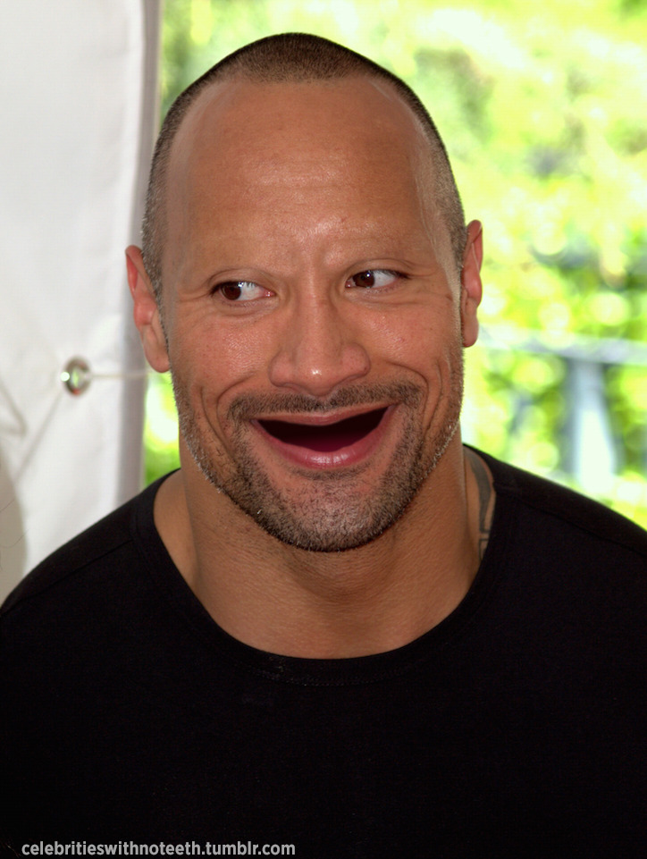 celebrities without eyebrows and teeth