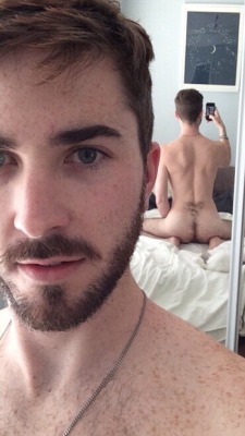 teenfuzz:cool back fur