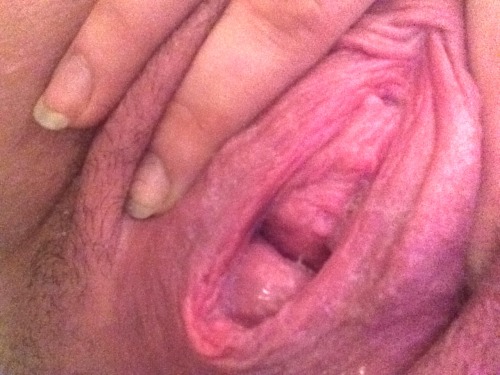 happygirlemilyp:  loosepussyland:  happygirlemilyp:  This is what my cunt looks like now! Daddy used to call it my pussy but he says it’s a cunt now !! What do you guys think of my cunt ?!  I think it shows what you are - a slut. Nice sag to it. Looks