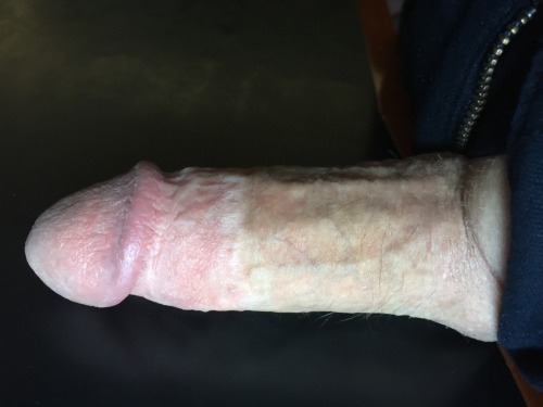 robscirc: Day 566 - Nov 19 Wow
