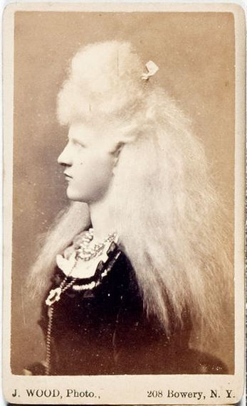 ca. 1870s, [carte de visite portrait of the beautiful albino performer Aggie Zolidra], J. Wood