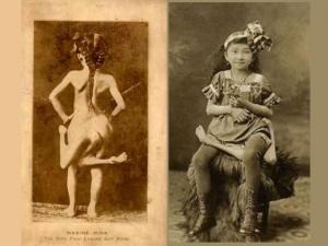 Maxine Mina was born in the philippines in 1896. She was born with a parasitic twin that produced 2 extra legs. She had complete control of her extra legs, but they eventually became attrophied from disuse. She was called “the four legged latina&rdq