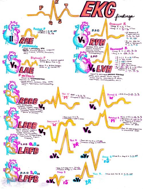 hansonsanatomy: Important EKG findings!