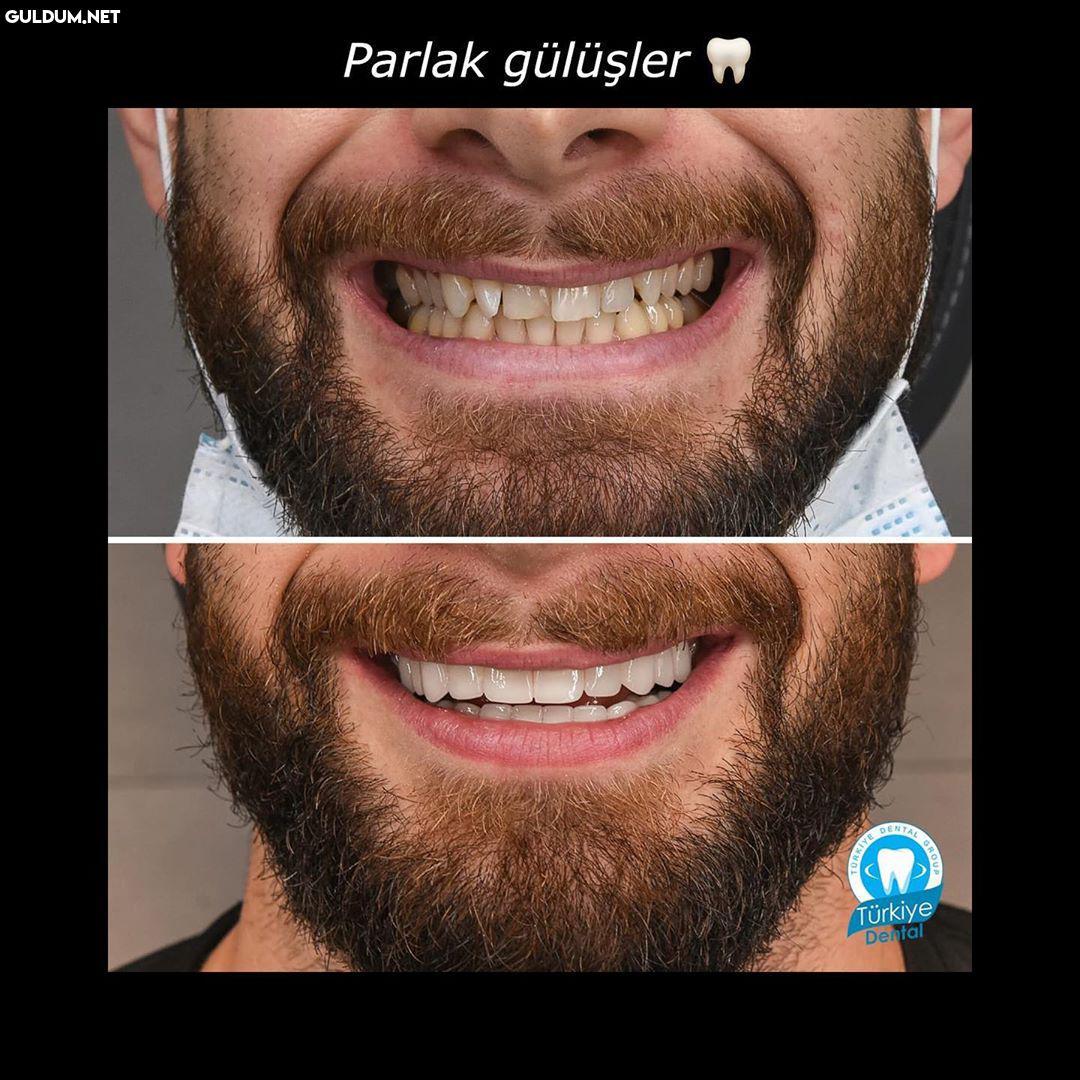 @turkeydental 👈...