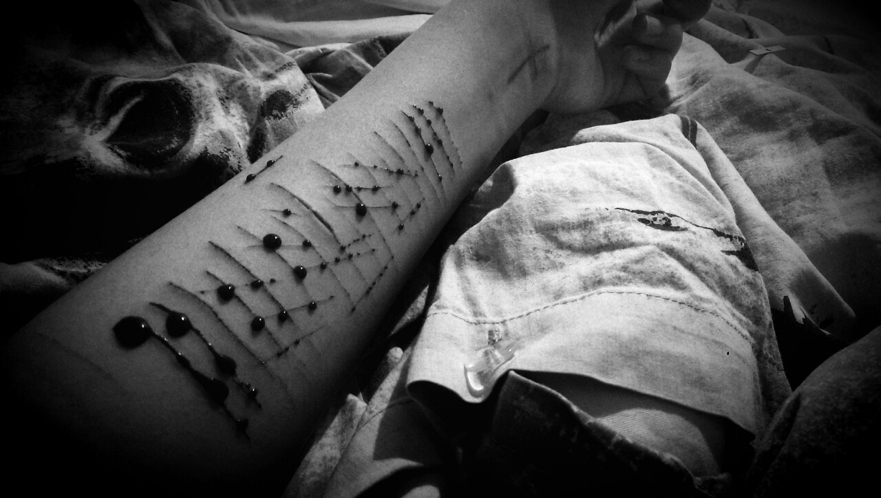 wonderfulunhappy:  shantibalu: Ja, das ist mein arm. 