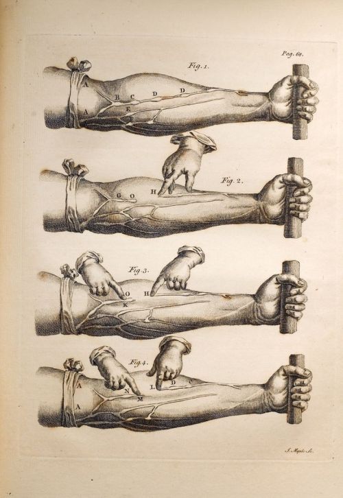 theartfulgene:This drawing illustrates an experiment preformed by William Harvey to show that veins 