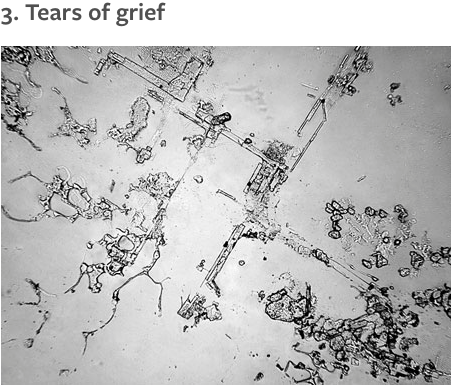 lipstickstainedlove:womaninterrupted:policymic:Stunning photos of tears under a microscope vary by e