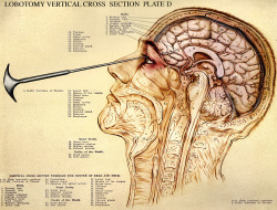   tw:-lobotomy | Tumblrwww.tumblr.com  