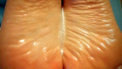 sweetcandytoes:  Close up of her oily, wrinkled