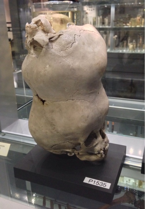 super-who-lock-is-team-jem: crookedindifference: I spent the afternoon at the Hunterian Museum in Lo