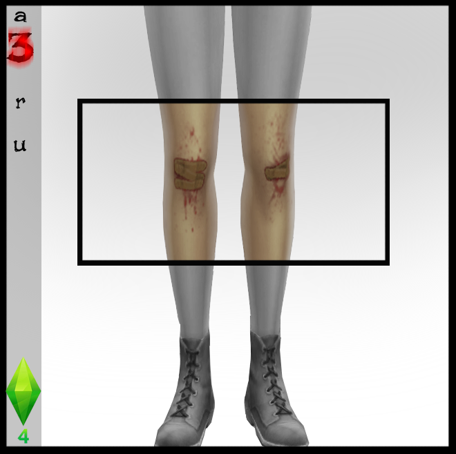 SLUMS — Scraped/Bloody knees with bandaids. Stand alone...