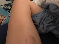 sluttylilalice:  If he doesn’t leave bruises what’s the point?