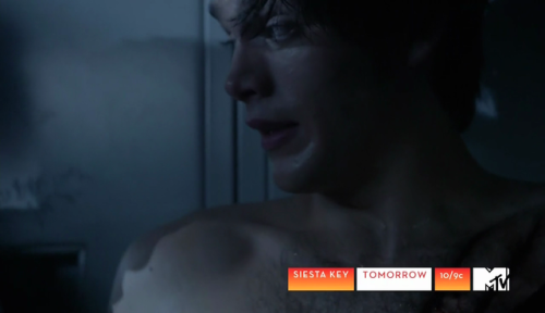 auscap:Dylan Sprayberry - Teen Wolf
