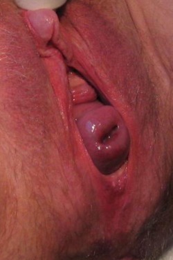 Guchman999:  Nice  Wow, Check Out The Combo Of That Massive Hard Clit And That Prolapsing