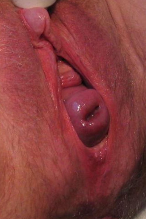 guchman999:  Nice  WOW, check out the combo of that massive hard clit and that prolapsing cervix! I’d love to lick her cunt and fuck her with something huge.
