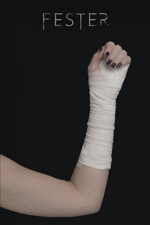 banditsregina:fanfic aesthetics: ‘Fester’ by @whasupwhereitisRegina lets the wounds on her arm feste