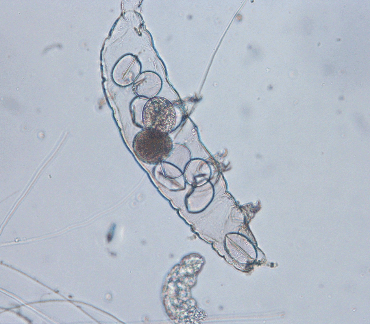 Бактерии в слюне. Трихомонады в световой микроскоп. Тихоходка инфузория. Микроб трихомонады под микроскопом. Микробы в слюне под микроскопом.
