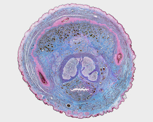 cross-section of a developing penis the urethra (flattened horizontal lumen), capped here by the pai