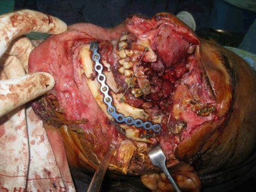 tossingtelevisions: Here we have some nasty skull/facial trauma, looks cleaned up to me. For those o