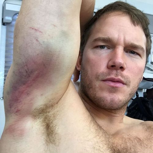 Male Celebrity Armpits