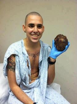 congenitaldisease:  A man holding his old heart after a successful heart transplant. 