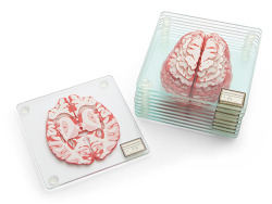 xandria1313:  roadkillraccoon:  laughingsquid:  A 10-Piece Set of Stackable Brain Specimen Coasters  Mmmm  I have a mighty need