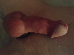 small-cock-ordeal:Tightly circumcised  Perfect