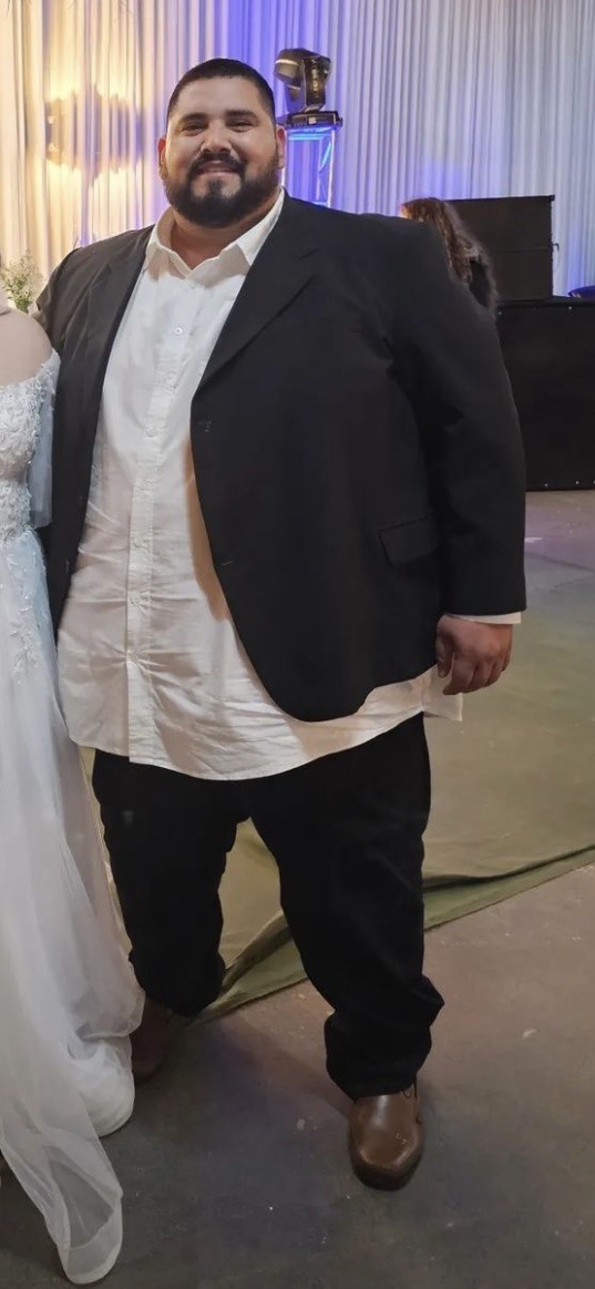 He Stopped Being A Thin Man To Be An Extreme Obese Man In A Few Years 2017-2023 150 Lbs- 500 Pounds
