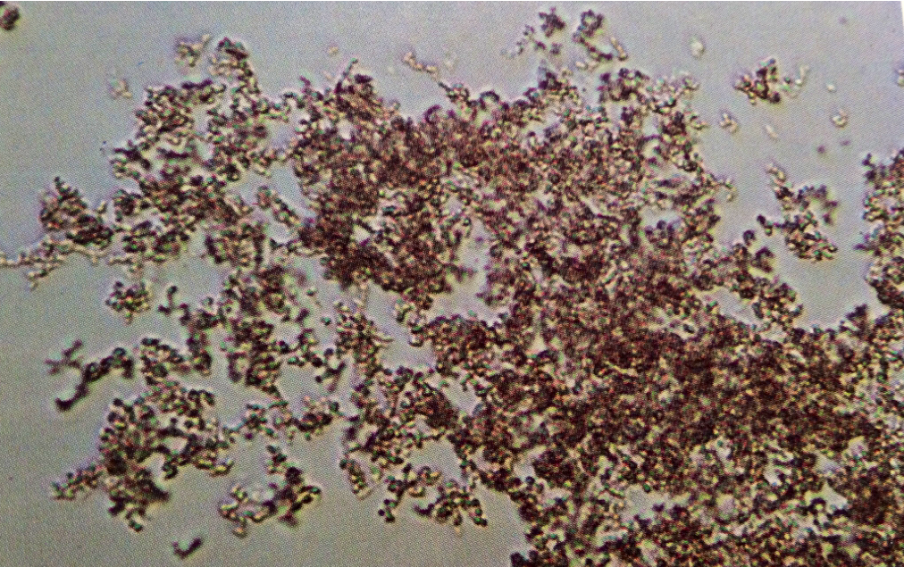 amorphous urates in urine