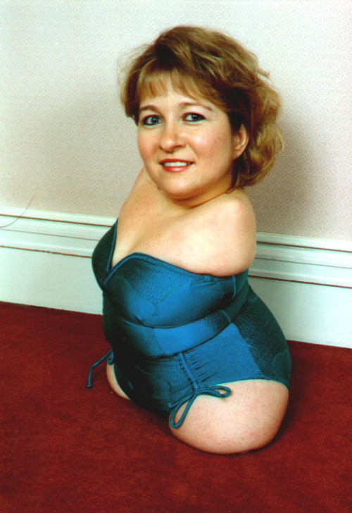 ilikeamputees:  Inmiddels een oude vrouw? (via TumbleOn)  Suzanne Solomon, a quad beauty