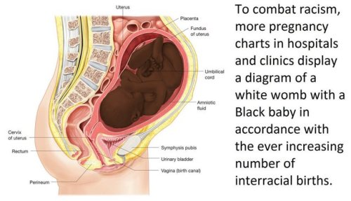 chinesehotwife44: wife-jennie: This is a wonderful idea and shows how far OBGYN medicine has advance