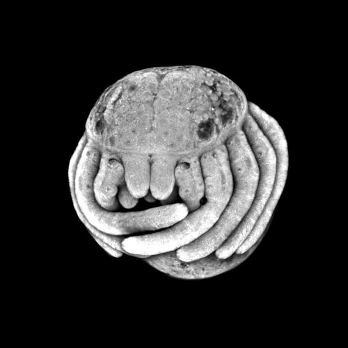 moonycore:freshphotons:Spider Embryo. Via Molecular characterization and embryonic origin of the eyes in the common house spider Parasteatoda tepidariorum. [Image ID: a round white spider on a black background that appears to be hugging itself, the spider