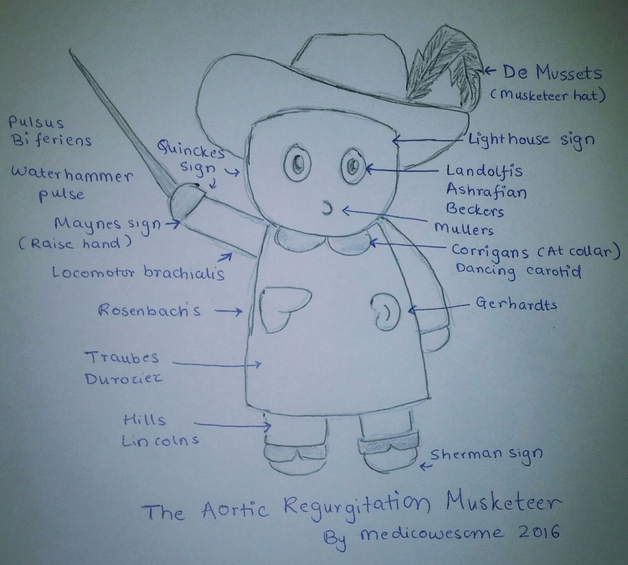 Signs seen in Aortic regurgitation mnemonic
